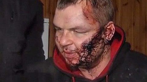 Ukraine Activist Says He Was Abducted and Tortured