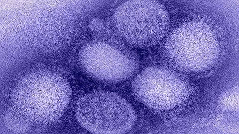 H1N1, H3N2 : les virus sous le microscope