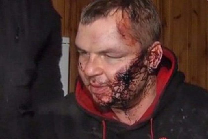 Ukraine Activist Says He Was Abducted and Tortured